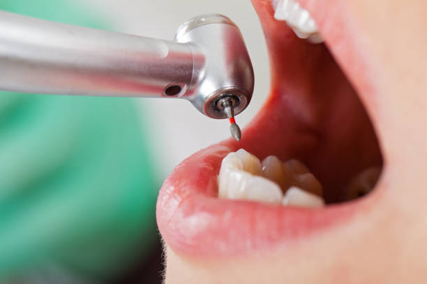 Best Emergency Dental Filling Replacement  in Hahira, GA